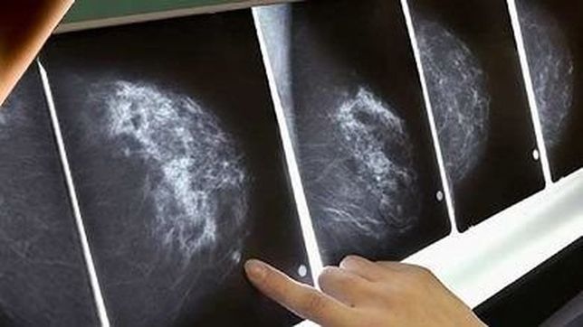 ob.sba presenta el plan de prevencion sobre salud mamaria integral ob.sba presenta el plan de prevencion sobre salud mamaria integral