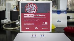 El NEOKIT-COVID-19, un test de diagnóstico rápido desarrollado por el Instituto Cesar Milstein (Conicet-Fundacion Cassara) durante la pandemia.