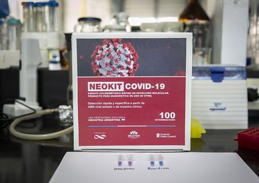 El NEOKIT-COVID-19, un test de diagnóstico rápido desarrollado por el Instituto Cesar Milstein (Conicet-Fundacion Cassara) durante la pandemia.