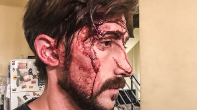 golpearon a un concejal de san martin: ?te vendio la policia?, le advirtieron