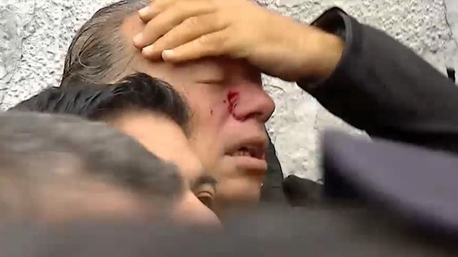 parte medico: berni padece un traumatismo craneo facial