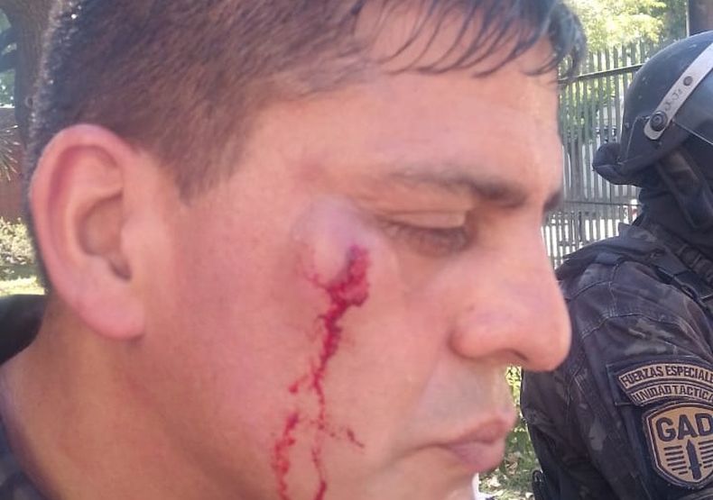 Uno de los cinco polic&iacute;as heridos.