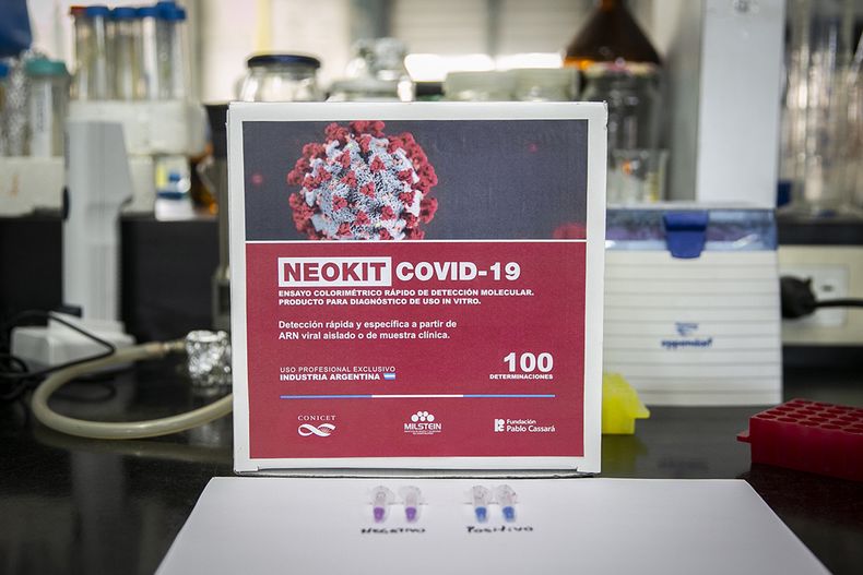 El NEOKIT-COVID-19, un test de diagnóstico rápido desarrollado por el Instituto Cesar Milstein (Conicet-Fundacion Cassara) durante la pandemia.