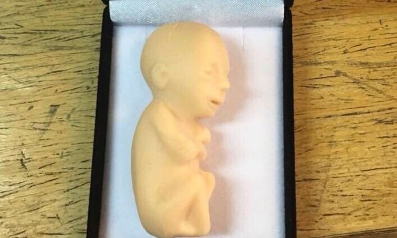 Bebito aborto